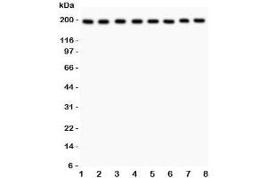 Western blot testing of ZO-1 antibody and Lane 1:  rat liver;  2: mouse liver;  3: (r) NRK;  4: (r) PC12;  5: human HeLa;  6: (h) SMMC-7721;  7: (m) HEPA;  8: (h) COLO320 lysate. (TJP1 Antikörper  (AA 1178-1527))