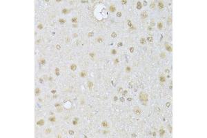 Immunohistochemistry of paraffin-embedded rat brain using HDAC3 Antibody (ABIN5971166) at dilution of 1/100 (40x lens). (HDAC3 Antikörper)