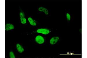 Immunofluorescence of monoclonal antibody to PHF11 on HeLa cell. (PHF11 Antikörper  (AA 1-292))