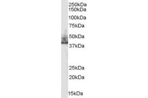 Image no. 1 for anti-Solute Carrier Family 9 (Sodium/hydrogen Exchanger), Member 3 Regulator 2 (SLC9A3R2) (Internal Region) antibody (ABIN374620)