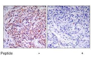 Image no. 1 for anti-Nuclear Factor-kB p65 (NFkBP65) (Thr435) antibody (ABIN197112) (NF-kB p65 Antikörper  (Thr435))