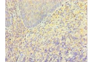 Immunohistochemistry of paraffin-embedded human tonsil tissue using ABIN7172857 at dilution of 1:100 (TRPM2 Antikörper  (AA 1204-1503))