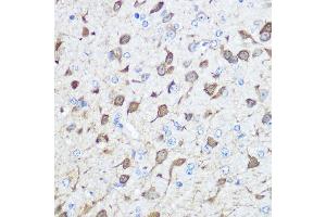 Immunohistochemistry of paraffin-embedded human esophageal using Parvalbumin (Parvalbumin (PVALB)) Rabbit pAb (ABIN6128526, ABIN6146506, ABIN6146507 and ABIN6217573) at dilution of 1:100 (40x lens). (PVALB Antikörper  (AA 1-110))