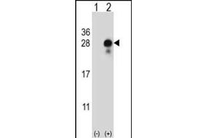 Western blot analysis of DLK2 (arrow) using rabbit polyclonal DLK2 Antibody (C-term) (ABIN652972 and ABIN2842616).