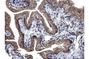 Immunohistochemistry (IHC) image for anti-Prohibitin 2 (PHB2) antibody (ABIN2855290)