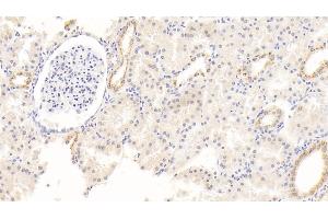 Detection of ALB in Human Kidney Tissue using Monoclonal Antibody to Albumin (ALB) (Albumin Antikörper)