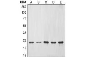 Western blot analysis of ERAS expression in HeLa (A), Jurkat (B), mouse liver (C), PC12 (D), rat kidney (E) whole cell lysates.