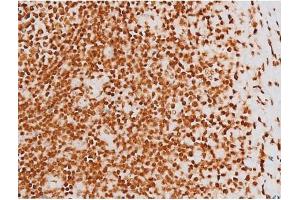 ABIN6267604 at 1/200 staining Human tonsil tissue sections by IHC-P. (c-Rel Antikörper  (pSer503))
