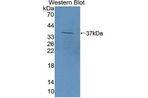 Detection of Recombinant F5, Bovine using Polyclonal Antibody to Coagulation Factor V (F5) (Coagulation Factor V Antikörper  (AA 30-327))