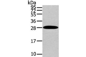 Western Blot analysis of Human liver cancer tissue using ZNF365 Polyclonal Antibody at dilution of 1/200 (ZNF365 Antikörper)