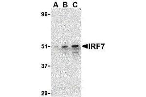 Western Blotting (WB) image for anti-Interferon Regulatory Factor 7 (IRF7) (C-Term) antibody (ABIN2475147) (IRF7 Antikörper  (C-Term))