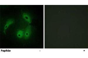 Immunofluorescence analysis of HeLa cells, using AKAP14 polyclonal antibody . (AKAP14 Antikörper)
