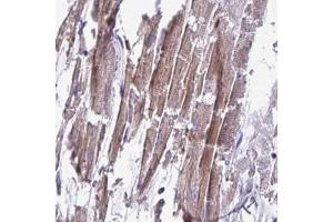 Immunohistochemical staining (Formalin-fixed paraffin-embedded sections) of human heart muscle with CD1E polyclonal antibody  shows moderate to strong cytoplasmic positivity in myocytes.