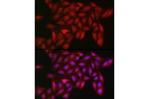 Immunofluorescence analysis of U2OS cells using LDHA Rabbit mAb  at dilution of 1:100 (40x lens). (Lactate Dehydrogenase A Antikörper)