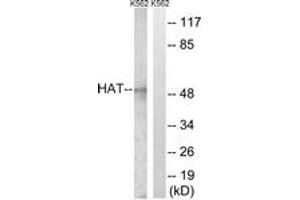 Western Blotting (WB) image for anti-Histone Acetyltransferase 1 (HAT1) (AA 331-380) antibody (ABIN2889272) (HAT1 Antikörper  (AA 331-380))
