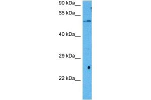 Host:  Mouse  Target Name:  RORA  Sample Tissue:  Mouse Liver  Antibody Dilution:  1ug/ml