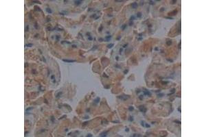 Used in DAB staining on fromalin fixed paraffin- embedded Kidney tissue (TUBD1 Antikörper  (AA 190-453))