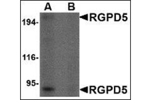 Western blot analysis of RGPD5 in human thymus tissue lysate with this product at 1 μg/ml in (A) the absence and (B) the presense of blocking peptide. (RGPD5 / RGPD6 (Center) Antikörper)