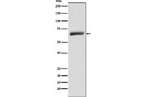 Western blot analysis of USP22 expression in HeLa cell lysate.