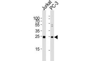 Western blot analysis of lysate from human Jurkat and rat PC-3 lysate using HMGB4 antibody diluted at 1:1000.