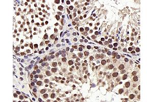 Immunohistochemistry analysis of paraffin-embedded mouse testis using HDAC1 Polyclonal Antibody at dilution of 1:300. (HDAC1 Antikörper)