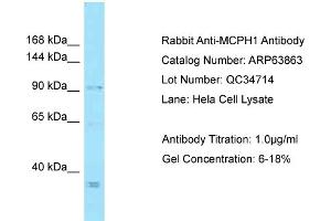 Western Blotting (WB) image for anti-Microcephalin 1 (MCPH1) (C-Term) antibody (ABIN2789647) (MCPH1 Antikörper  (C-Term))