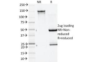 SDS-PAGE Analysis Purified GAD2 (GAD65) Mouse Monoclonal Antibody (GAD2/1960). (GAD65 Antikörper  (AA 6-99))