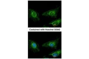 ICC/IF Image Immunofluorescence analysis of methanol-fixed HeLa, using Asporin, antibody at 1:200 dilution.