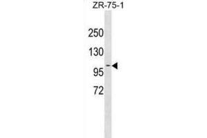 Western Blotting (WB) image for anti-Programmed Cell Death 6 Interacting Protein (PDCD6IP) antibody (ABIN3001245) (ALIX Antikörper)