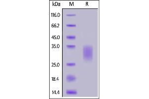 Biotinylated Human IL-22, His,Avitag™ on  under reducing (R) condition.