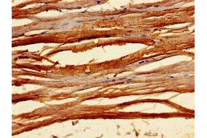 Immunohistochemistry (IHC) image for anti-Cardiac Troponin C (TNNC1) (AA 11-149) antibody (ABIN7173569)