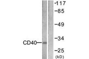 Western blot analysis of extracts from COS7 cells, using CD40 Antibody. (CD40 Antikörper  (AA 228-277))
