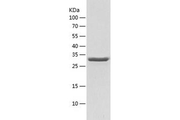 GAPDH Protein (AA 1-333) (His tag)