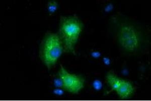 Anti-MGRN1 mouse monoclonal antibody (ABIN2454424) immunofluorescent staining of COS7 cells transiently transfected by pCMV6-ENTRY MGRN1 (RC208284). (Mahogunin RING Finger Protein 1 Antikörper)
