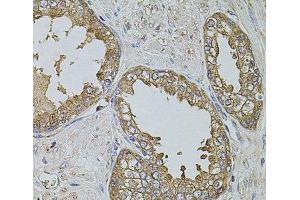 Immunohistochemistry of paraffin-embedded Human prostate using KTN1 Polyclonal Antibody at dilution of 1:100 (40x lens).
