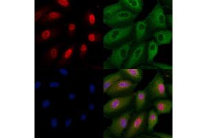ABIN7093964 and ABIN7098008 staining  cells by IF/ICC.