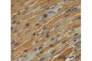 Used in DAB staining on fromalin fixed paraffin- embedded heart tissue (KEAP1 Antikörper  (AA 1-286))