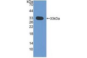 Detection of Recombinant CDK4, Human using Polyclonal Antibody to Cyclin Dependent Kinase 4 (CDK4) (CDK4 Antikörper  (AA 6-295))