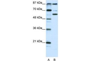 Western Blotting (WB) image for anti-K(lysine) Acetyltransferase 2B (KAT2B) antibody (ABIN2460477) (KAT2B Antikörper)