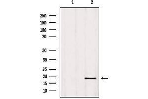 Western blot analysis of extracts from 293, using C9orf23 Antibody. (RPP25L Antikörper  (C-Term))