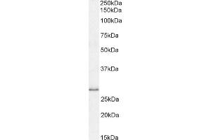 Western Blotting (WB) image for anti-Myeloid Differentiation Primary Response Gene (88) (MYD88) (Internal Region) antibody (ABIN185362)