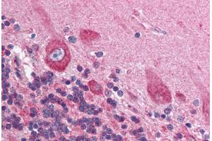 Human Brain, Cerebellum (formalin-fixed, paraffin-embedded) stained with HIF1AN antibody ABIN214112 at 5 ug/ml followed by biotinylated goat anti-rabbit IgG secondary antibody ABIN481713, alkaline phosphatase-streptavidin and chromogen. (HIF1AN Antikörper  (N-Term))