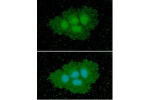 ICC/IF analysis of ASS1 in Hep3B cells line, stained with DAPI (Blue) for nucleus staining and monoclonal anti-human ASS1 antibody (1:100) with goat anti-mouse IgG-Alexa fluor 488 conjugate (Green).