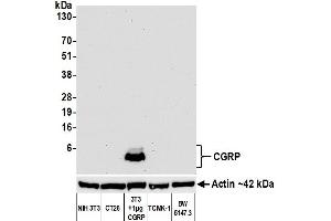 Western Blotting (WB) image for anti-Calcitonin-Related Polypeptide alpha (CALCA) antibody (ABIN7449372) (Rekombinanter CGRP Antikörper)