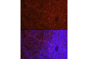 Immunofluorescence analysis of rat spleen cells using ASC/TMS1 Rabbit pAb (ABIN3021616, ABIN3021617, ABIN3021618, ABIN1513454 and ABIN6215392) at dilution of 1:250 (40x lens). (PYCARD Antikörper  (AA 50-195))