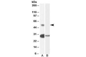 Western blot testing of human testis lysate with TCFL5 antibody at 0. (TCFL5 Antikörper)