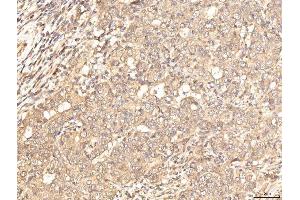 IHC analysis of BHMT using anti-BHMT antibody (ABIN7599940). (BHMT Antikörper  (AA 13-386))