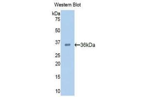Western Blotting (WB) image for anti-Proprotein Convertase Subtilisin/kexin Type 9 (PCSK9) (AA 156-461) antibody (ABIN1860147) (PCSK9 Antikörper  (AA 156-461))