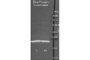 Goat anti antibody  was used to detect purified Beta Phospho Glucomutase under reducing (R) and non-reducing (NR) conditions. (Beta-Phosphoglucomutase Antikörper)