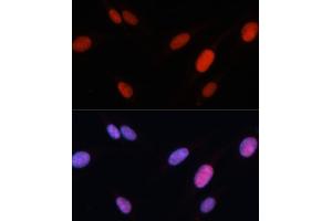 Immunofluorescence analysis of U-2 OS cells using FOSL2 antibody (ABIN3016548, ABIN3016549, ABIN3016550 and ABIN6219779) at dilution of 1:100. (FOSL2 Antikörper  (AA 187-326))